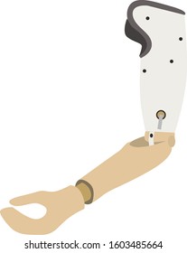 Prosthetic Arm. Mechanism, Medicine, Disability, Equipment. Vector Illustration Isolated On White Background.
