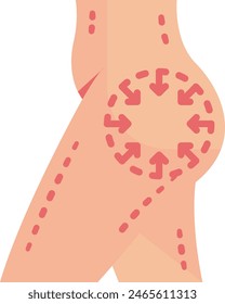 Prosthetic Leg implant Surgery concept, artificial limb vector flat design, plastic surgeon Symbol, body contouring Sign, Beauty treatment stock illustration
