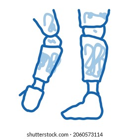 Prosthetics Of Arms And Leg Orthopedic sketch icon vector. Hand drawn blue doodle line art isolated symbol illustration