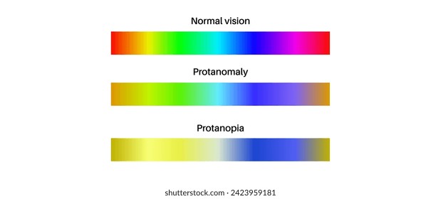 Protanomaly, protanopia and normal vision, color blindness infographic. Human vision deficiency concept. Difference between colors, brightness and intensity of shades flat vector illustration