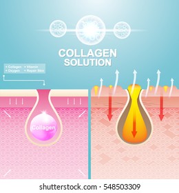 Protection Skin and Repairing or Collagen Serum and Vitamin Repair Skin