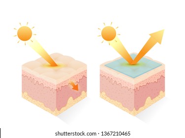 Protection UV ray of skin with uv filter and without. Illustration about sunblock cream and uv body lotion.
