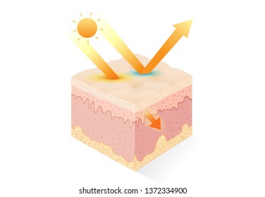 Protection UV ray of skin with uv filter and without. Illustration about sunblock cream and uv body lotion.