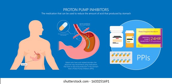 Proton pump inhibitors drugs PPIs medication treatment stomach acid Gastroesophageal reflux disease GERD H2 receptor blockers Pepcid AC over the counter long term use side effects Peptic Barrett