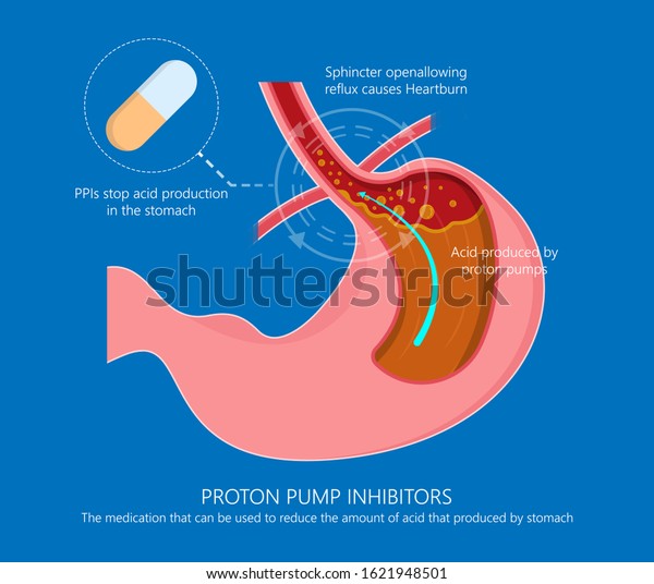 Proton pump inhibitors drugs PPIs medication\
treatment stomach acid Gastroesophageal reflux disease GERD H2\
receptor blockers Pepcid AC over the counter long term use side\
effects Peptic Barrett