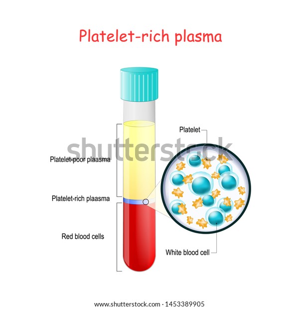 Prp Test Tube Blood Plateletrich Plasma Stock Vector Royalty Free