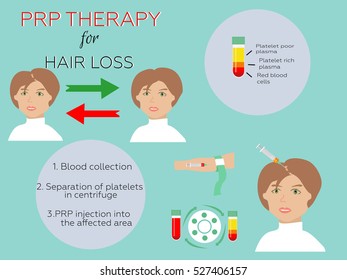  PRP therapy process. Platelet rich plasma injection.  Meso therapy. Hair growth stimulation