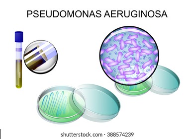 Pseudomonas aeruginosa. bacterial inoculation