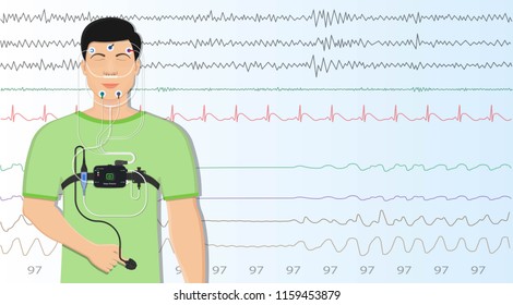 PSG sleep study test apnea diagnose Periodic limb movement disorder positive airway pressure CPAP restless leg syndrome Epworth Sleepiness Scale