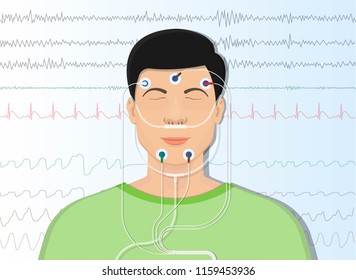 PSG Sleep Study Test Apnea Diagnose Periodic Limb Movement Disorder Positive Airway Pressure CPAP Restless Leg Syndrome Epworth Sleepiness Scale