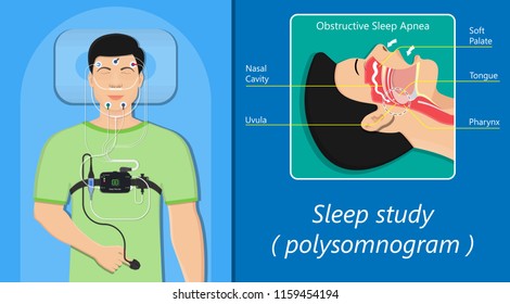 PSG Sleep Study Test Apnea Diagnose Periodic Limb Movement Disorder Positive Airway Pressure CPAP Restless Leg Syndrome Epworth Sleepiness Scale