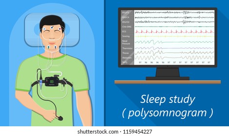 PSG sleep study test apnea diagnose Periodic limb movement disorder positive airway pressure CPAP restless leg syndrome Epworth Sleepiness Scale