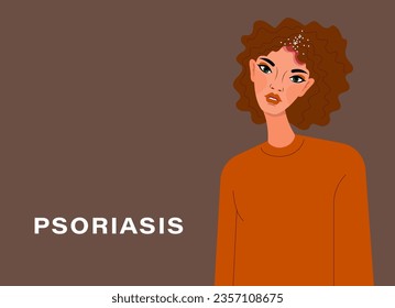 Psoriasis awareness. Psoriasis affected area of the skin. Dermatological skin disease. psoriasis, eczema, dermatitis, allergies. Skin lesions on the head