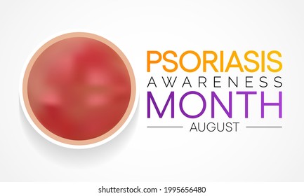 Psoriasis awareness month is observed every year in August, it is a skin condition that causes red, flaky, crusty patches of skin covered with silvery scales. Vector illustration
