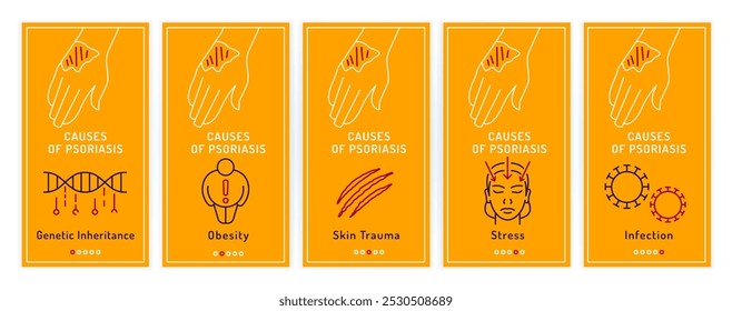 A psoríase causa infográfico linear. Fatores de dermatite médica. Cartaz informativo sobre placas eritematosas, faixa. Doença psoriática. Traçado editável. Ilustração vetorial isolada em um fundo branco