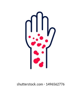 Psoriasis, dermatitis line color icon. concept. Skin rash. Dermatological diseases. Itchy spots on hand. Sign for web page, mobile app, button, logo. Vector isolated element. Editable stroke.