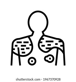 psoriasis disease line icon vector.  isolated contour symbol black illustration