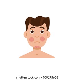 Psoriasis or rosacea men face. Vector illustration.