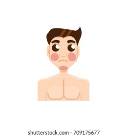 Psoriasis or rosacea men face. Vector illustration.