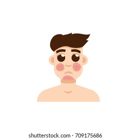 Psoriasis or rosacea men face. Vector illustration.