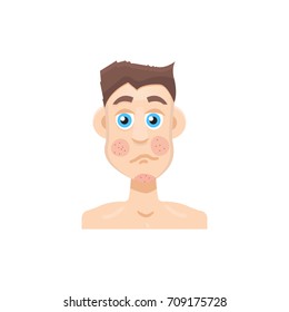 Psoriasis or rosacea men face. Vector illustration.
