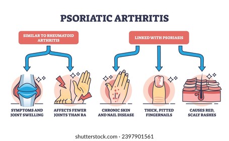 Psoriasis-Arthritis als Skizze für chronische dermatologische Hautkrankheiten. Bezeichnetes Bildungsprogramm mit Krankheitssymptomen wie Gelenkschwellung, Fingernägel mit Knöchelspitzen und Hautausschlag, Vektorgrafik.