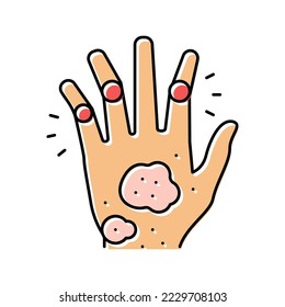 psoriatic arthritis skin health problem color icon vector. psoriatic arthritis skin health problem sign. isolated symbol illustration