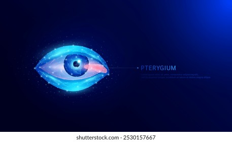 Pterigión que crece en la córnea y el cristalino conjuntival. Enfermedades comunes de los ojos. Causa irritación ocular y visión borrosa. Diagnóstico de ciencia médica. Polígono de órgano humano sobre fondo oscuro. Vector 10.