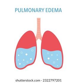 Pulmonary edema lung disease concept vector illustration on white background.