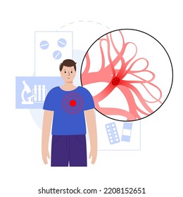 Pulmonary Embolism Disease. Deep Vein Thrombosis In Male Cartoon Body. Blood Clot In Lung Vein Anatomical Poster. Blocking Blood Flow In Lungs. Circulatory System Problem. DVT Vector Illustration