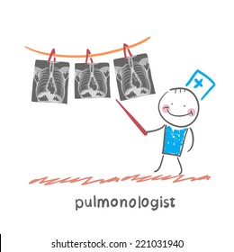 pulmonologist shows an X-ray of human lung