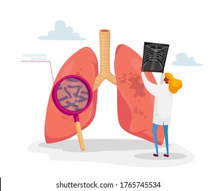 Pulmonology Specialist, Professional Doctor Character Holding X-ray Image Of Lungs Learning Patient Fluorography With Tuberculosis Or Pneumonia Disease, Medical Staff Work. Cartoon Vector Illustration