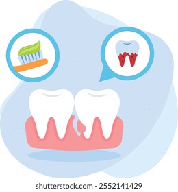 Pulpitis Tratamientos de fluoruro para el tártaro y la placa concepto de dientes afectados, diseño de ícono de color de Vector de absceso periapical, símbolo de odontología, signo de atención médica, instrumento dental ilustración de stock