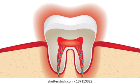 pulsation of sensitive tooth enamel. Vector illustration