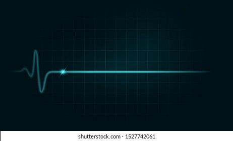 Pulse rate Line while dead on green chart background of monitor. Illustration about heart failure and Cardiogram monitor.
