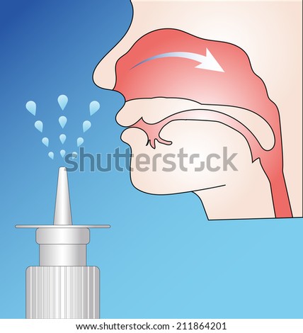 Pump nasal spray and nasal mucosa scheme