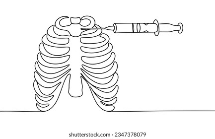 Puncture of the bone marrow in the human chest. Sternal puncture. World Marrow Donor Day. One line drawing for different uses. Vector illustration.