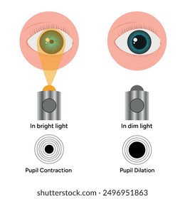 Pupil size changes by Refraction eye ophthalmology, medical illustration