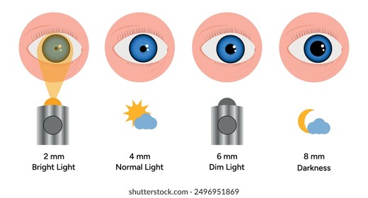 Pupil size changes by Refraction eye ophthalmology, medical illustration