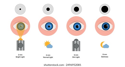 Pupil size changes by Refraction eye ophthalmology, medical information