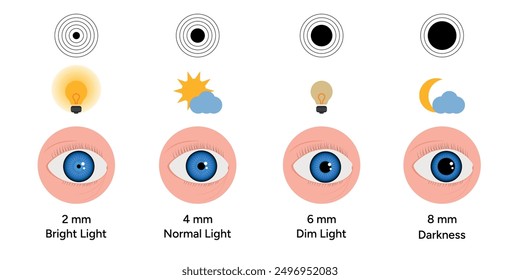 Pupil size changes by Refraction eye ophthalmology, medical information