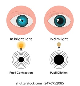 Pupil size changes by Refraction eye ophthalmology, medical information