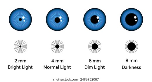 Pupil size changes by Refraction eye ophthalmology, medical information