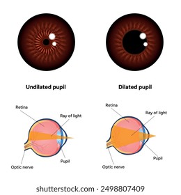 Pupil size in different lighting, Dilated pupil
and Undilated pupil  with Eye anatomy ophthalmology diagram 