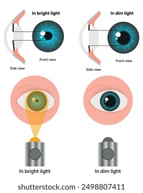 Pupil size in different lighting, Dilated pupil
and Undilated pupil  with Eye anatomy ophthalmology diagram 