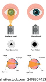 Pupil size in different lighting, Dilated pupil
and Undilated pupil  with Eye anatomy ophthalmology diagram 