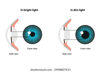 Pupil size in different lighting, Dilated pupil
and Undilated pupil  with Eye anatomy ophthalmology diagram 