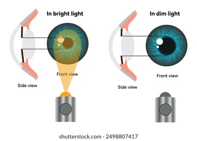 Pupil size in different lighting, Dilated pupil
and Undilated pupil  with Eye anatomy ophthalmology diagram 