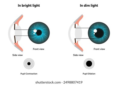 Pupil size in different lighting, Dilated pupil
and Undilated pupil  with Eye anatomy ophthalmology diagram 