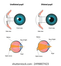 Pupil size in different lighting, Dilated pupil
and Undilated pupil  with Eye anatomy ophthalmology diagram 